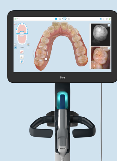 Digital scanner